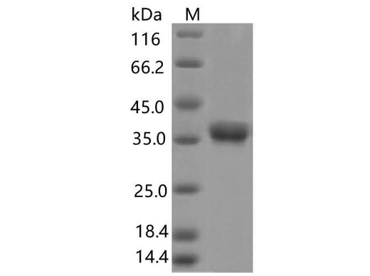 > 85 % as determined by reducing SDS-PAGE.
