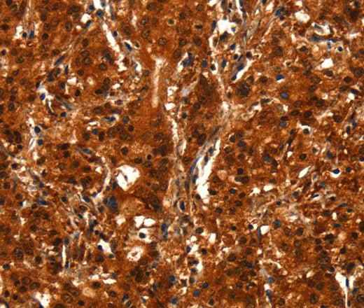 Anti-Human/Mouse BCAS3 Antibody - ABMIUM