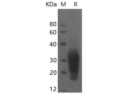 SDS-PAGE analysis of Mouse Interleukin-13/IL-13 proteins, 2 μg/lane of Recombinant Mouse Interleukin-13/IL-13 proteins was resolved with SDS-PAGE under reducing conditions, showing bands at 25 kDa.