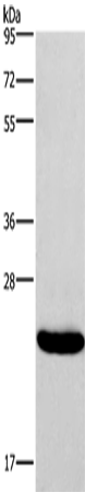 Anti-Human IFNA16 Antibody - ABMIUM