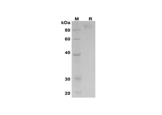 SDS-PAGE analysis of Human PECAM1/CD31 proteins, 2 μg/lane of Recombinant Human PECAM1/CD31 proteins was resolved with SDS-PAGE under reducing conditions, showing bands at 100 kDa.
