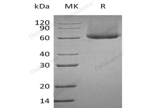 Recombinant Human CRTAM /CD355 Protein (His Tag) - ABMIUM