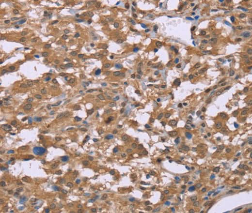 Anti-Human IFNA2 Antibody