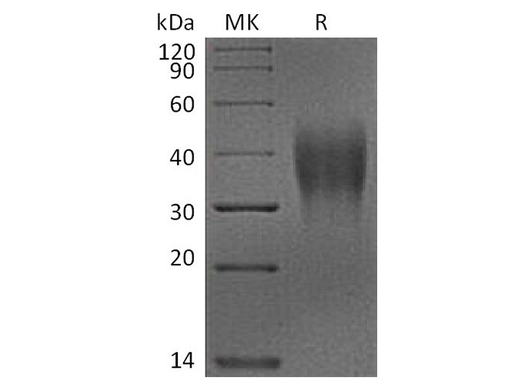 Recombinant Cynomolgus VSIR Protein (His Tag) - ABMIUM