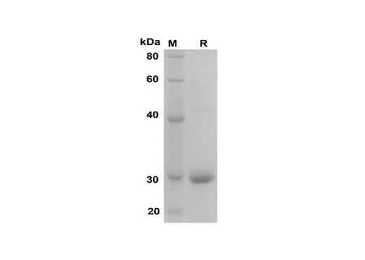 SDS-PAGE analysis of Rat I-PTH proteins, 2 μg/lane of Recombinant Rat I-PTH proteins was resolved with SDS-PAGE under reducing conditions, showing bands at 30 kDa.