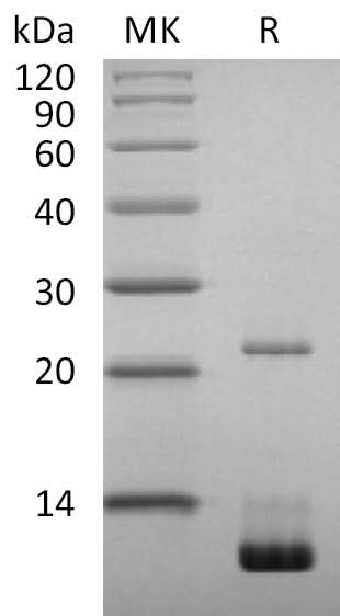 Recombinant SARS-CoV-2 NSP7 Protein (His Tag) - ABMIUM