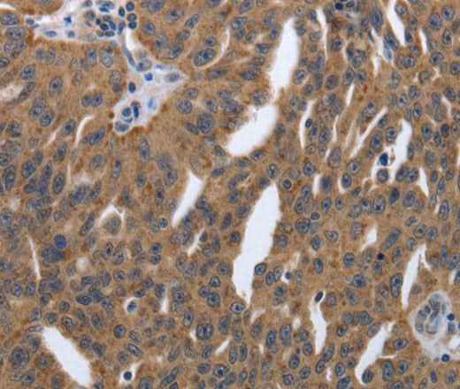 Anti-Human/Mouse/Rat PDGFA Antibody