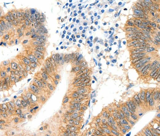 Anti-Human SIPA1 Antibody - ABMIUM