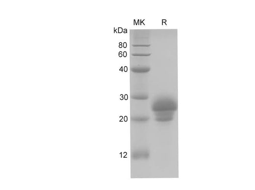 SDS-PAGE analysis of Rat OC/BGP proteins, 2 μg/lane of Recombinant Rat OC/BGP proteins was resolved with SDS-PAGE under reducing conditions, showing bands at 28 kDa.