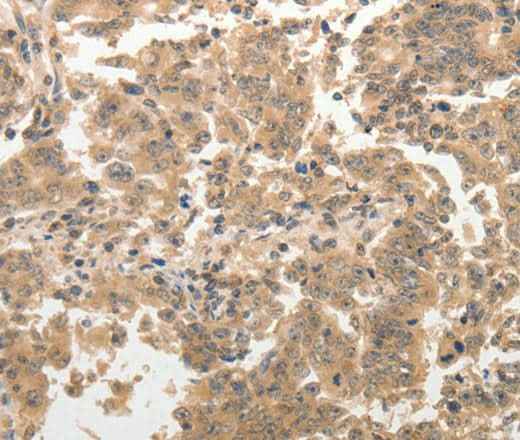 Anti-Human ADAR Antibody