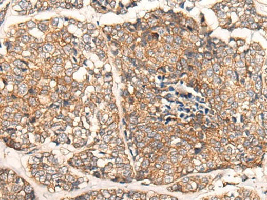 Anti-Human/Mouse/Rat CACNA2D2 Antibody - ABMIUM
