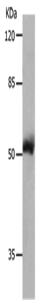 Anti-Human MMP8 Antibody - ABMIUM