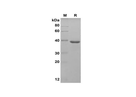 SDS-PAGE analysis of Human Annexin A1/ANXA1 proteins, 2 μg/lane of Recombinant Human Annexin A1/ANXA1 proteins was resolved with SDS-PAGE under reducing conditions, showing bands at 38 kDa.