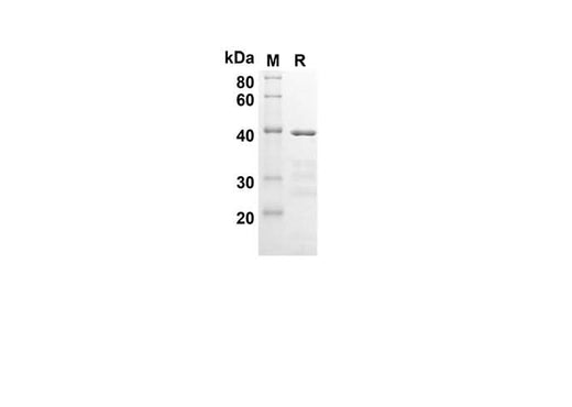 SDS-PAGE analysis of Human BCL2 proteins, 2 μg/lane of Recombinant Human BCL2 proteins was resolved with SDS-PAGE under reducing conditions, showing bands at 43.1 kDa.