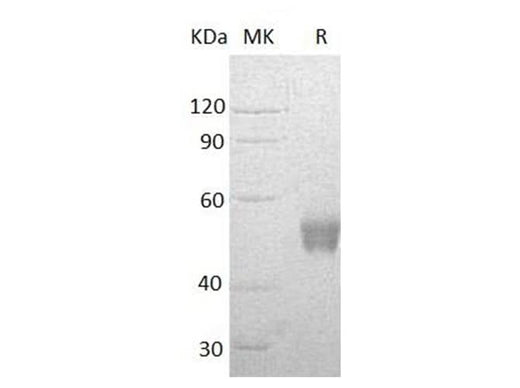Recombinant Human NCR3/NKp30 Protein (Fc Tag) - ABMIUM