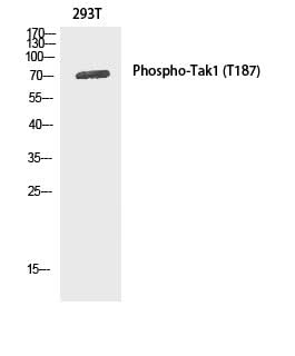 Western Blot analysis of 293T cells using Phospho-MAP3K7 (Thr187) Polyclonal Antibody at dilution of 1:1000