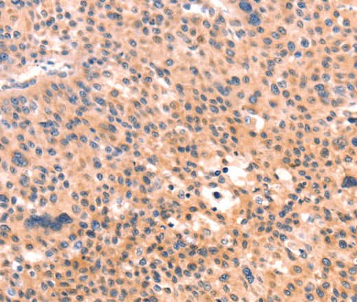 Anti-Human APBA2 Antibody - ABMIUM