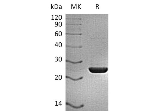 Recombinant HIV p24 protein (C-6His) - ABMIUM