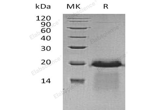 Recombinant Human APBA3 Protein (His Tag) - ABMIUM