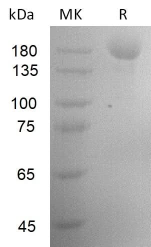 Recombinant SARS-CoV-2 S-trimer(D614G, N439K)(His Tag) - ABMIUM