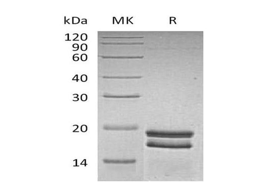 Recombinant Human SUMO1 Protein (His Tag) - ABMIUM
