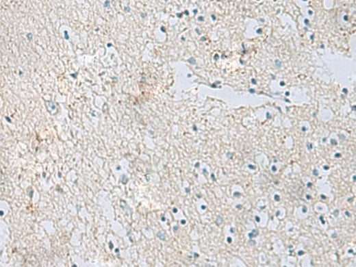 Immunohistochemistry of paraffin-embedded Human brain tissue using RDH5 Polyclonal Antibody at dilution of 1:50(×200)