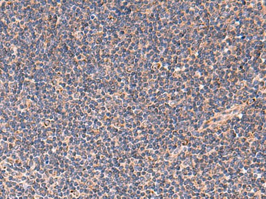 Immunohistochemistry of paraffin-embedded Human tonsil tissue using TNF Polyclonal Antibody at dilution of 1:40(×200)