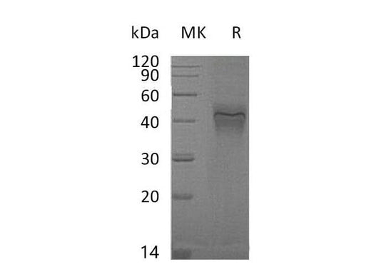 Recombinant Mouse IFNGR1 Protein (His Tag) - ABMIUM