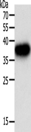 Anti-Human PLAUR Antibody - ABMIUM
