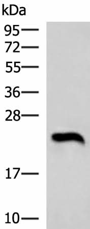Western blot analysis of Human heart tissue lysate using NEUROG3 Polyclonal Antibody at dilution of 1:1000