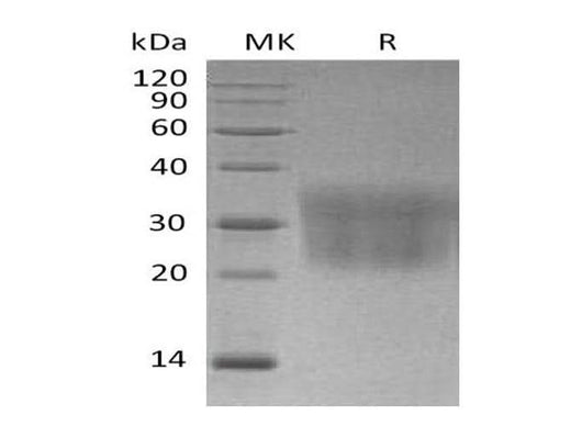 Recombinant Mouse CCL2/MCP-1 Protein (His Tag) - ABMIUM