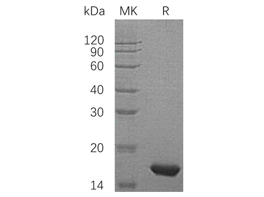 Recombinant Human PMP2/FABP8 Protein (His Tag) - ABMIUM