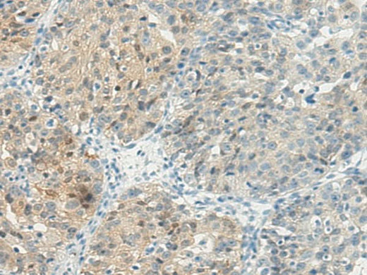 Anti-Human TBXA2R Antibody - ABMIUM