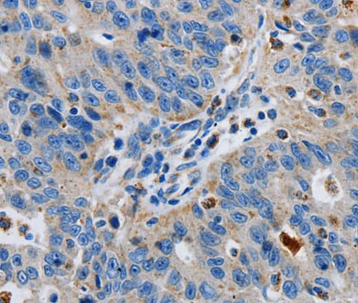 Anti-Human/Mouse/Rat GRIA3 Antibody - ABMIUM