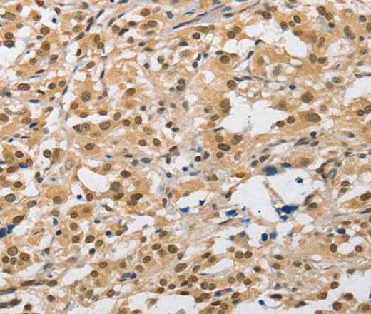 Anti-Human AMZ2 Antibody