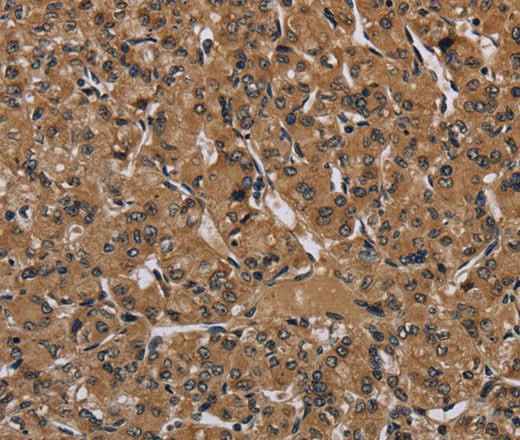 Anti-Human HIF1A Antibody