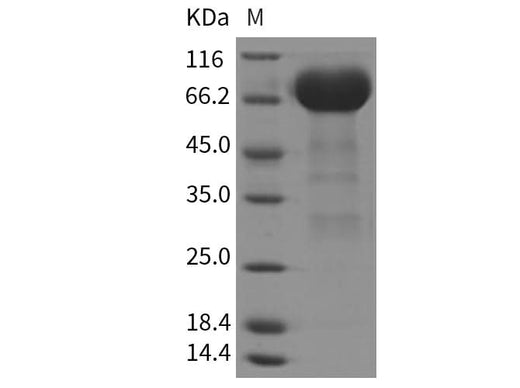 Recombinant Rat EphA3 Protein (His Tag) - ABMIUM
