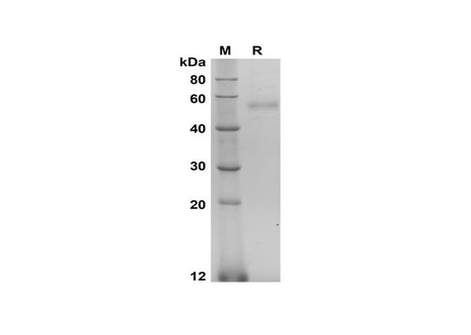 SDS-PAGE analysis of Human HYAL1 proteins, 2 μg/lane of Recombinant Human HYAL1 proteins was resolved with SDS-PAGE under reducing conditions, showing bands at 50-60 kDa.