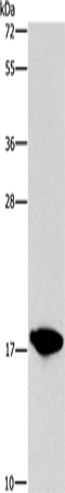 Anti-Human CCL16 Antibody - ABMIUM