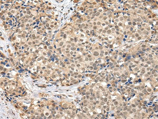 Anti-Human/Mouse TBL1X Antibody - ABMIUM