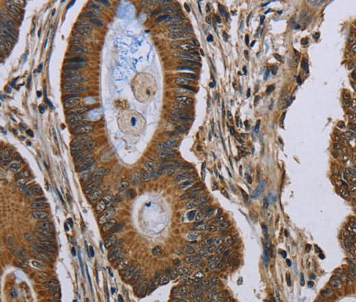 Anti-Human NEFH Antibody - ABMIUM