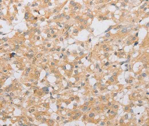 Anti-Human/Rat ATG9A Antibody