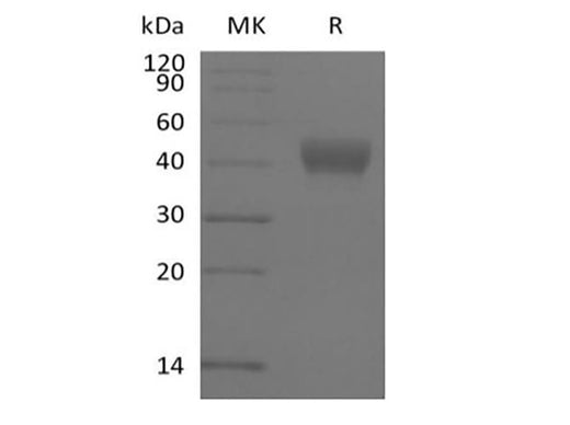 Recombinant Human ADP-ribosyl Cyclase/cyclic ADP-ribose Hydrolase 1/CD38 (N-6His-Avi) Biotinylated - ABMIUM