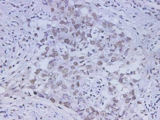 Anti-Human HMGB-1 Antibody - ABMIUM