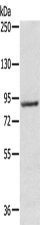 Anti-Human/Mouse/Rat RPS6KA1 Antibody - ABMIUM