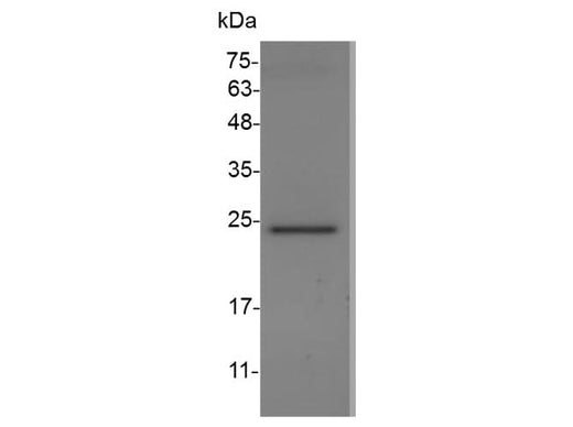 Recombinant Swine CXCL9 protein(His Tag) - ABMIUM