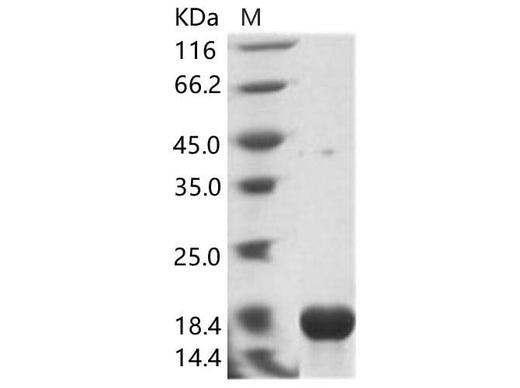Recombinant EBOV (Sudan ebolavirus, strain Gulu) Nucleoprotein / NP Protein (His Tag) - ABMIUM