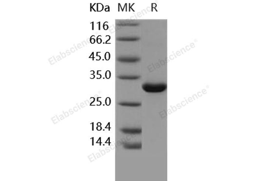 Recombinant Human MBL2/MBL/COLEC1 Protein - ABMIUM