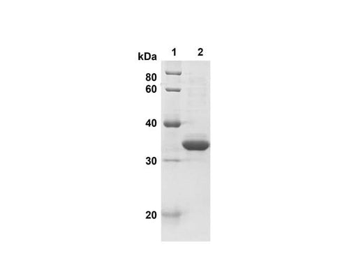 SDS-PAGE analysis of Human AIF1 proteins, 2 μg/lane of Recombinant Human AIF1 proteins was resolved with SDS-PAGE under reducing conditions, showing bands at 36 kDa.