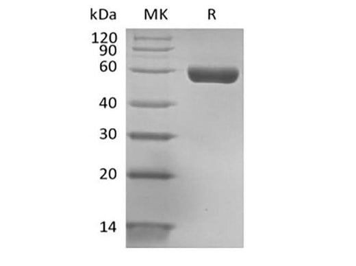 Recombinant Human HLA-A*0201 GP100 complex Protein (C-Avi-10His) Biotinylated - ABMIUM